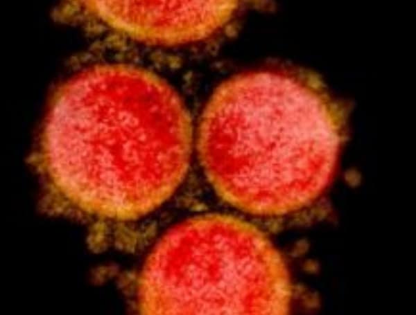 Transmission electron micrograph of SARS-CoV-2 virus particles, isolated from a patient. Image captured and color-enhanced at the NIAID Integrated Research Facility (IRF) in Fort Detrick, Maryland.NIAID