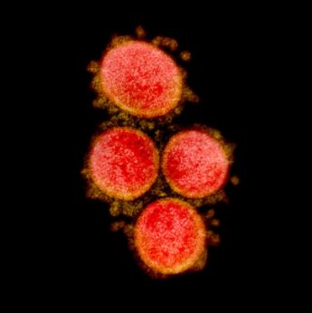 Transmission electron micrograph of SARS-CoV-2 virus particles, isolated from a patient. Image captured and color-enhanced at the NIAID Integrated Research Facility (IRF) in Fort Detrick, Maryland.NIAID