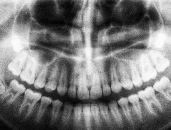 Dentist, X-Ray (File)